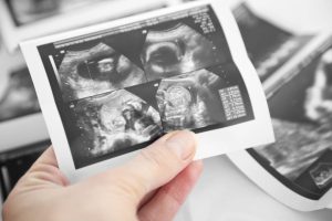 Reasons Why You Should Become an Ultrasound Technologist